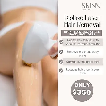 Diolaze laser hair removal promotional image.