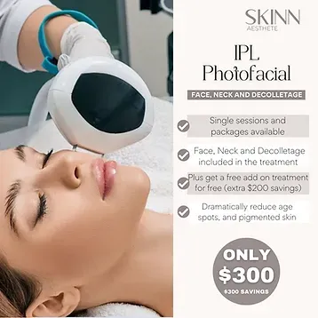 IPL Photofacial promotional image with treatment details.